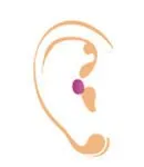 Completely-in-the-Canal (CIC) hearing aid