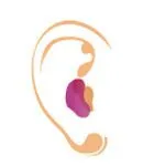 In-the-Canal (ITC) and Mini-Canal (MC) hearing aid