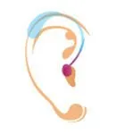 Receiver-in-the-Canal (RIC) hearing aid